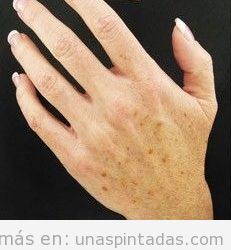 Una manicura perfecta sin manchas en la piel de las manos