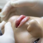 El aumento de labios, el tratamiento tendencia